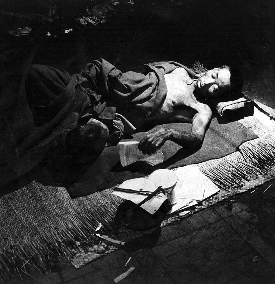 A victim of the Hiroshima atomic bomb is treated at a makeshift hospital in September 1945. Immediately after the bombing, Setsuko Thurlow sought to provide aid and comfort to wounded survivors. (Photo: Wayne Miller/Hulton Archive/Getty Images)